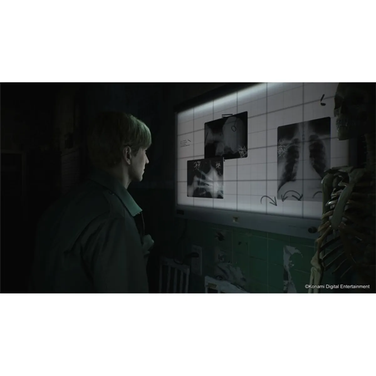 Silent Hill 2 Remake PS5 játékszoftver #10